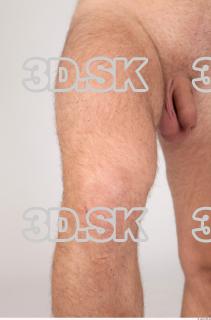 Knee texture of Vendelin 0001